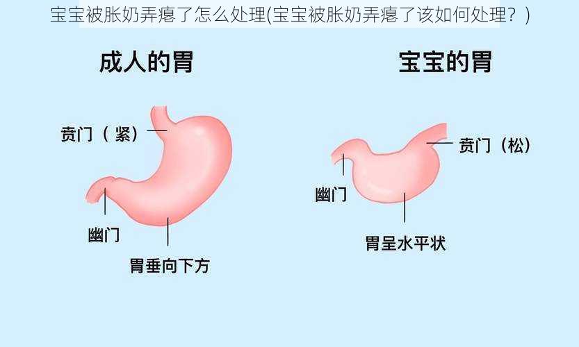 宝宝被胀奶弄瘪了怎么处理(宝宝被胀奶弄瘪了该如何处理？)