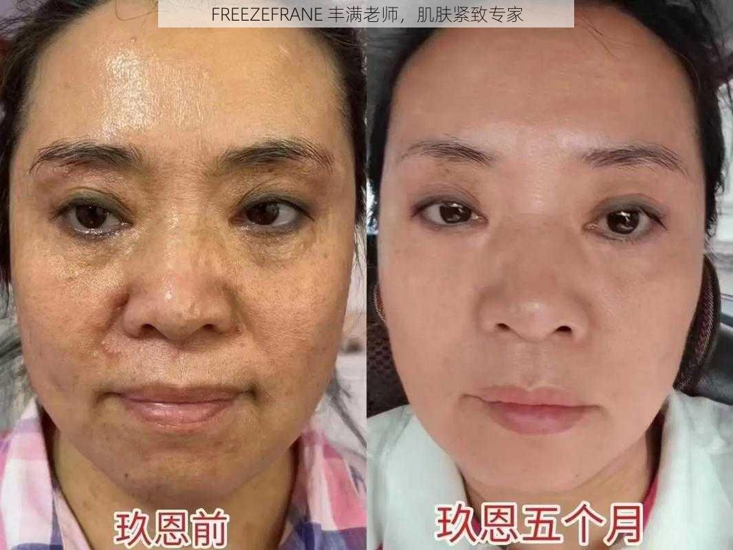 FREEZEFRANE 丰满老师,肌肤紧致专家