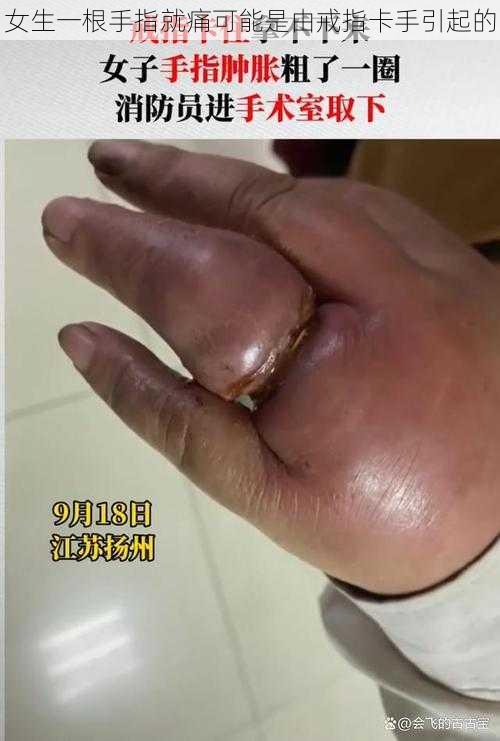 女生一根手指就痛可能是由戒指卡手引起的